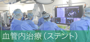 血管内治療（ステント）