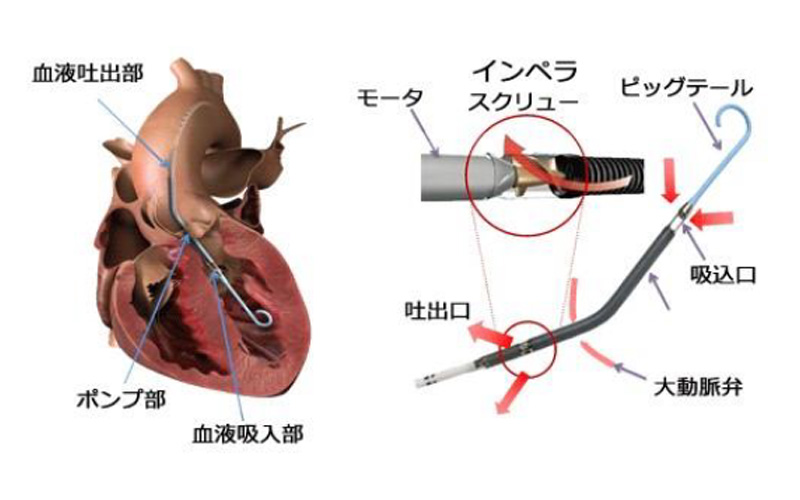 IMPELLA